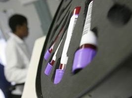 Haïti - Santé : Les USA aux côtés d’Haïti dans la lutte contre la tuberculose