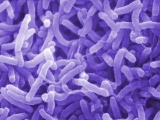 Haiti - Health - ALERT : At least 50 dead, cholera epidemic ?