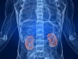 Haiti - Health : Towards better access to kidney transplant